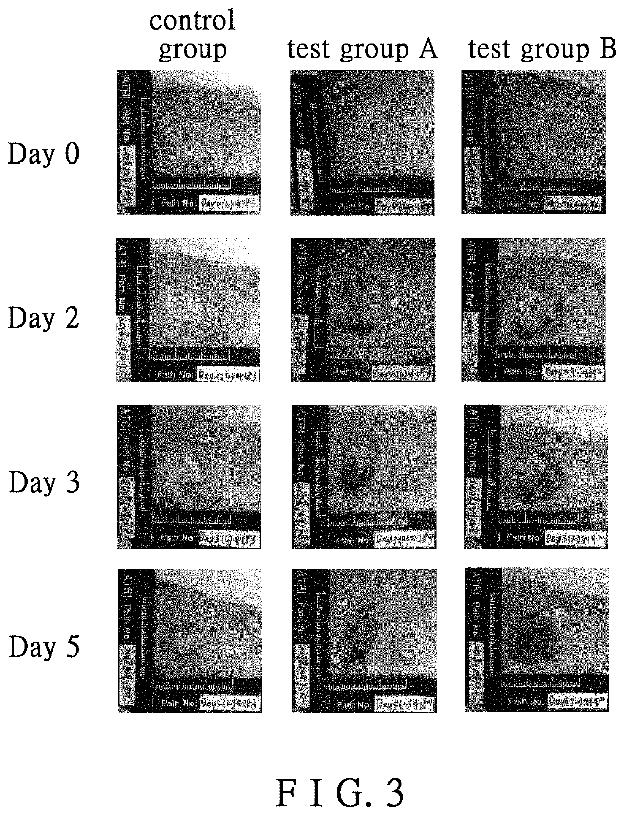 Pharmaceutical composition for prompting the skin wound healing and use therefor