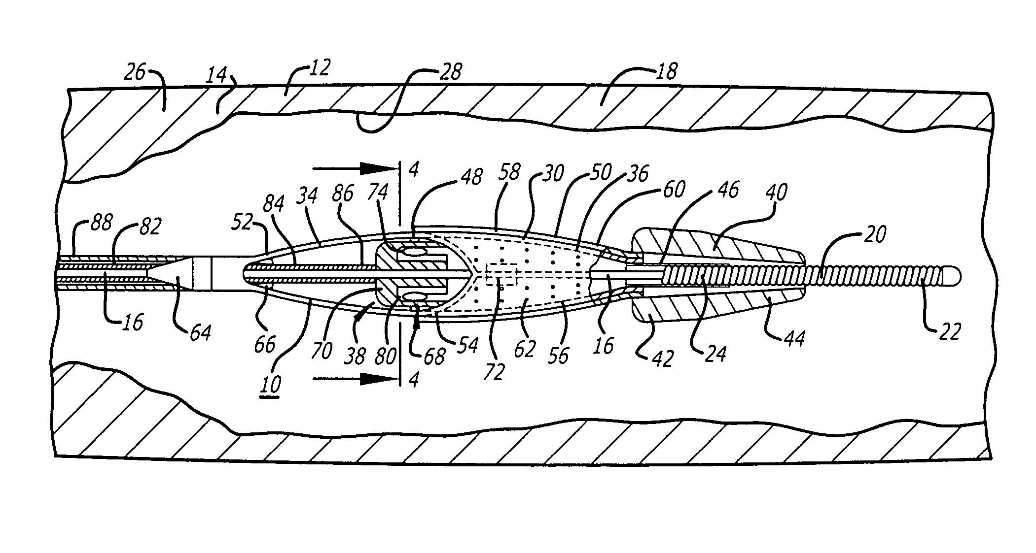 Sheathless embolic protection system