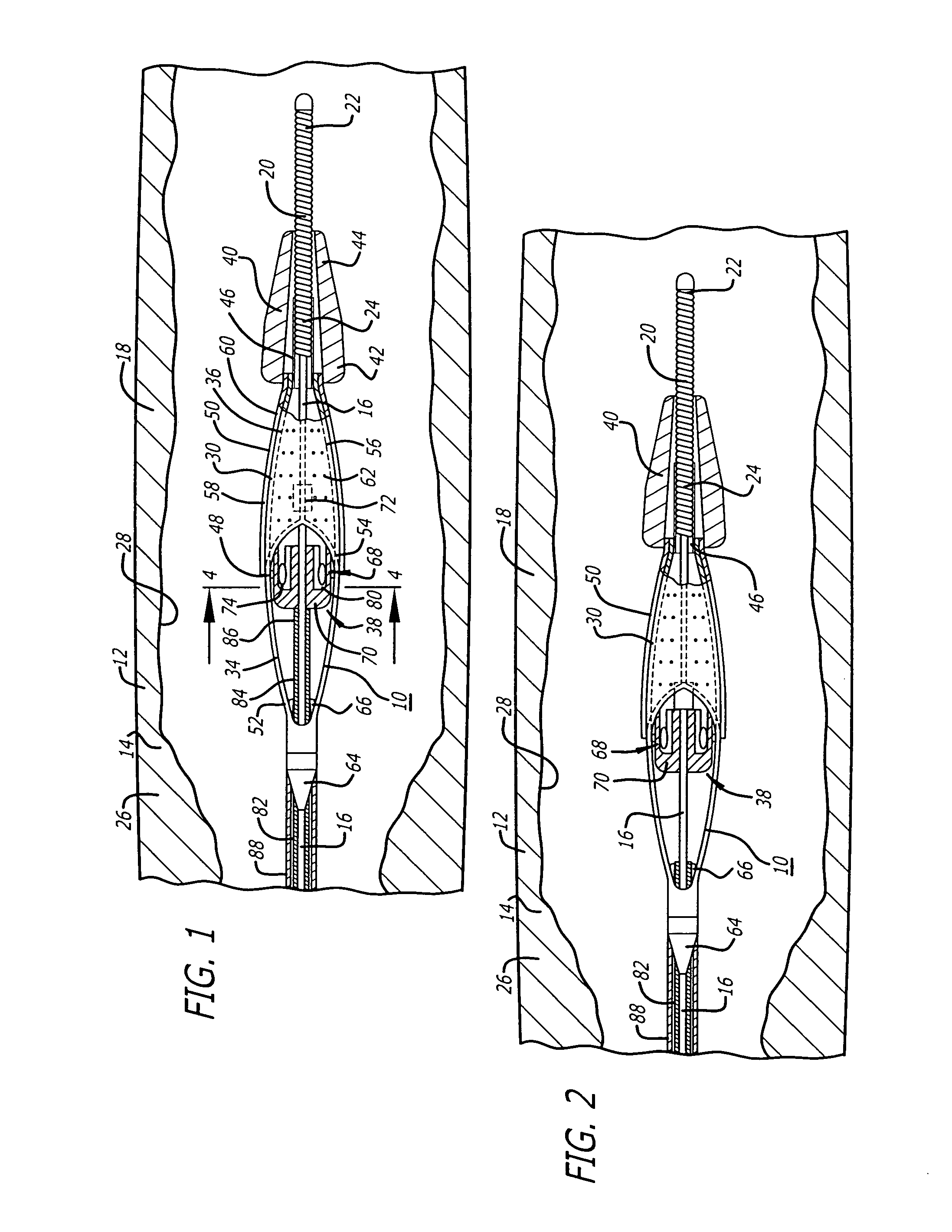 Sheathless embolic protection system