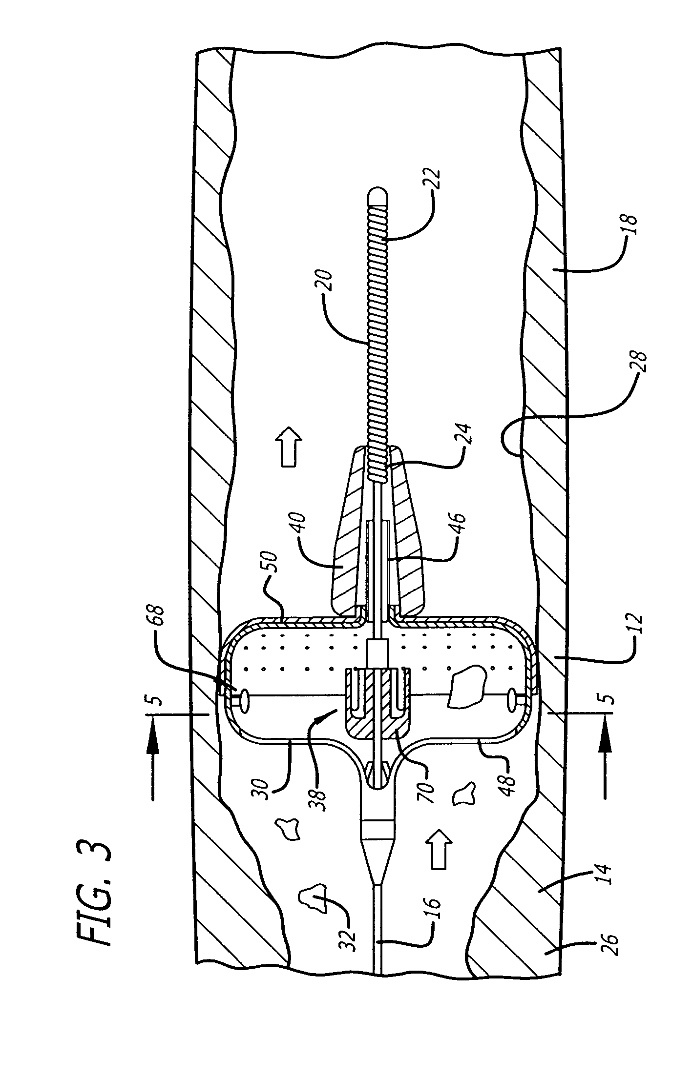 Sheathless embolic protection system