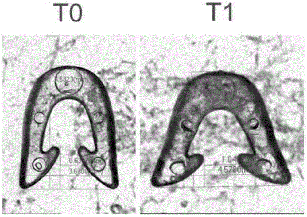 An absorbable skin suture staple and its preparation method