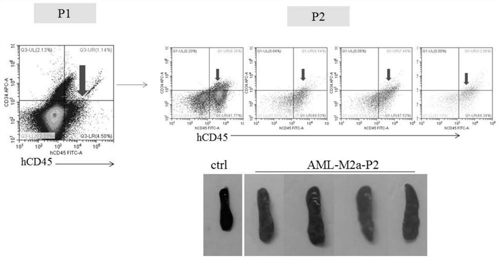 A PDX model establishment method of granulocytic tumor