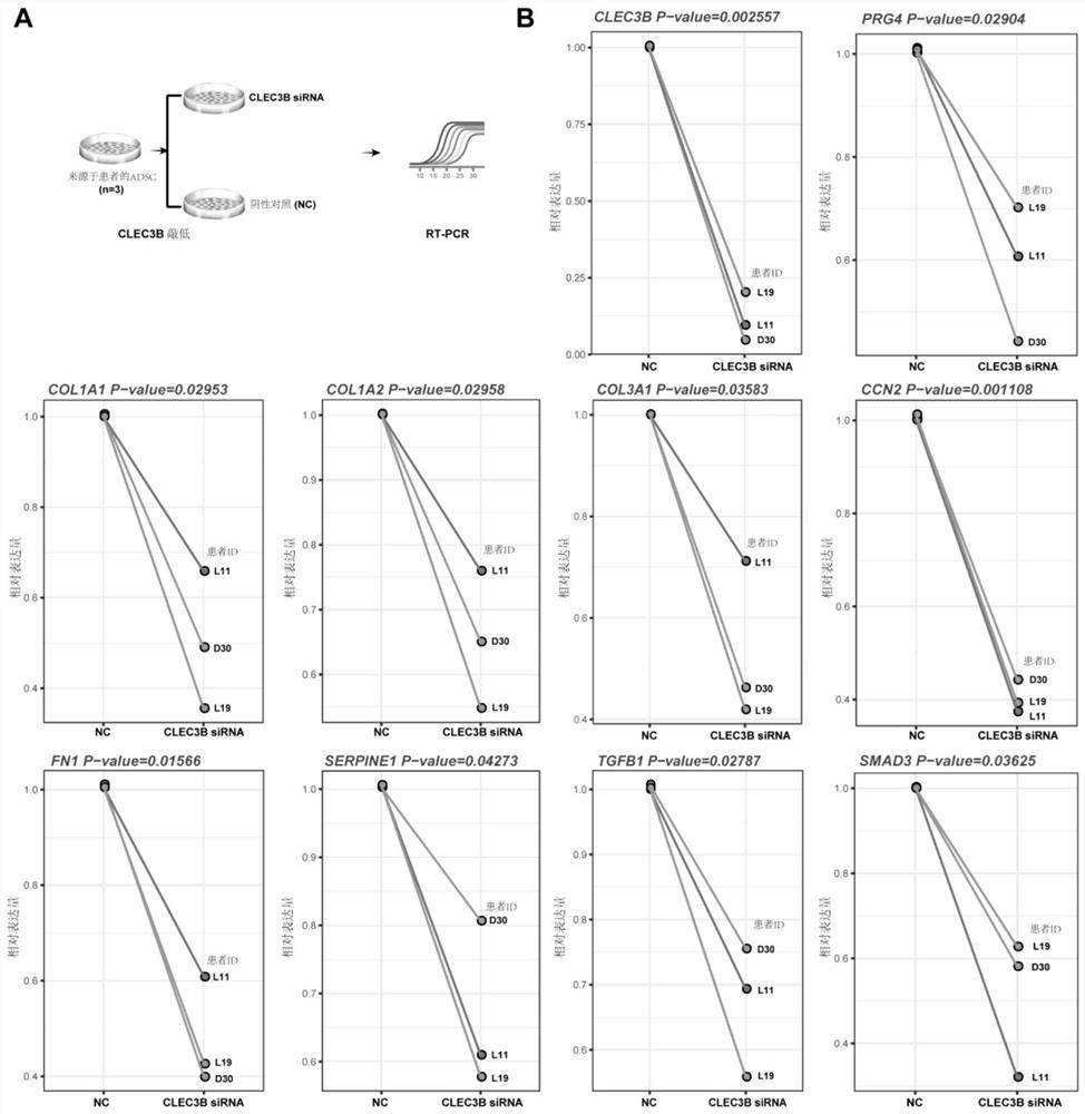 Drug intervention target for tumor-related secondary lymphedema and application thereof