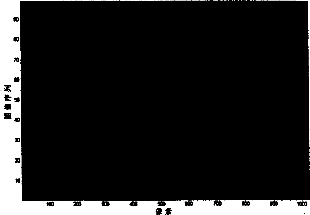 Method for determining automatic detection threshold of bad pixel of medical image