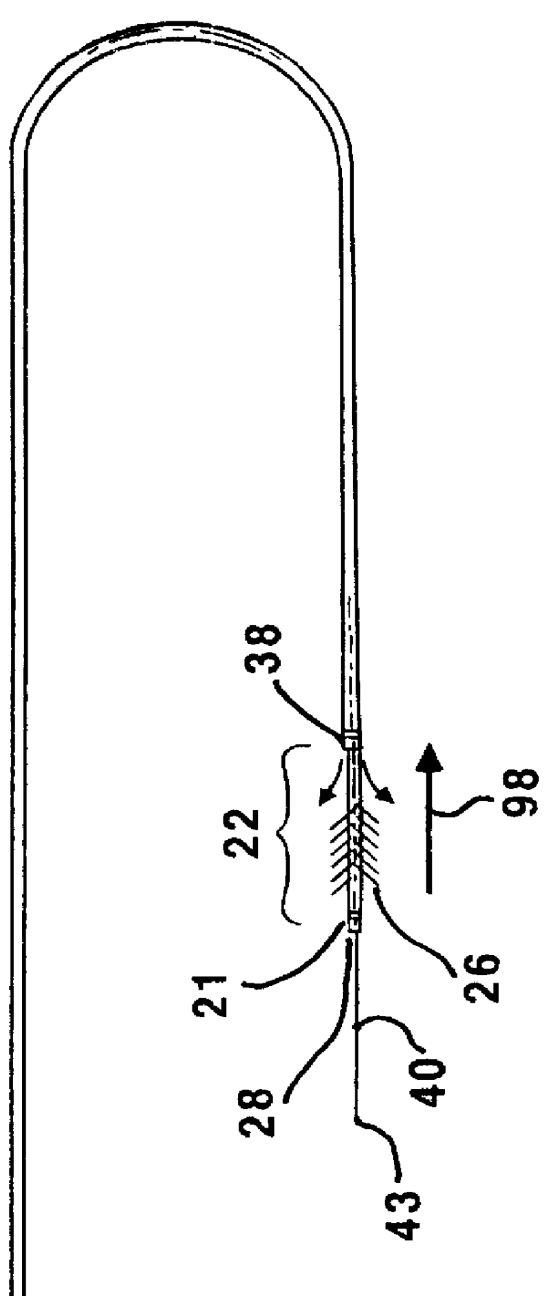 Rotatable attachment mechanism for attaching a medical obstruction treatment device sub-assembly to a drive motor unit