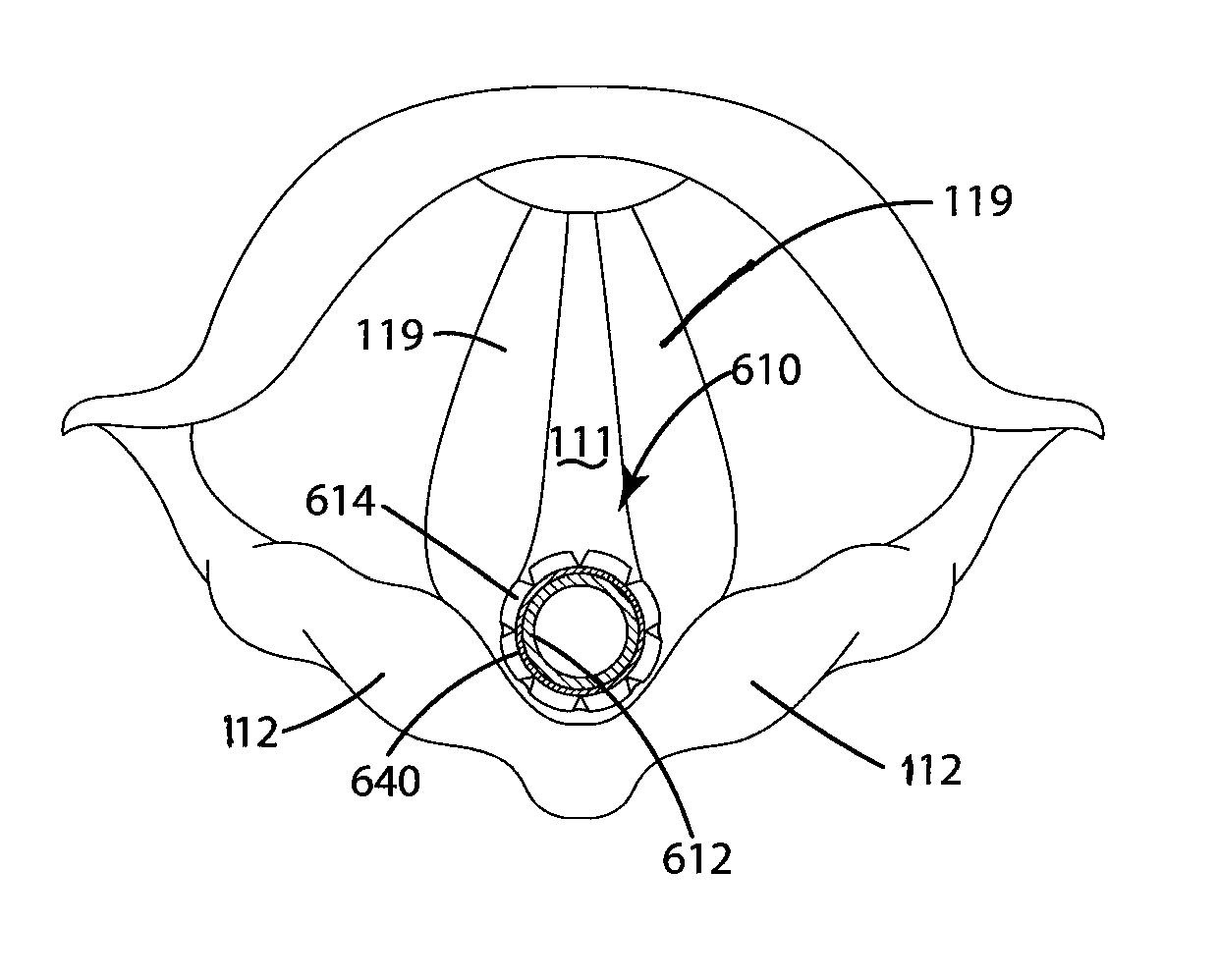 Nerve monitoring device