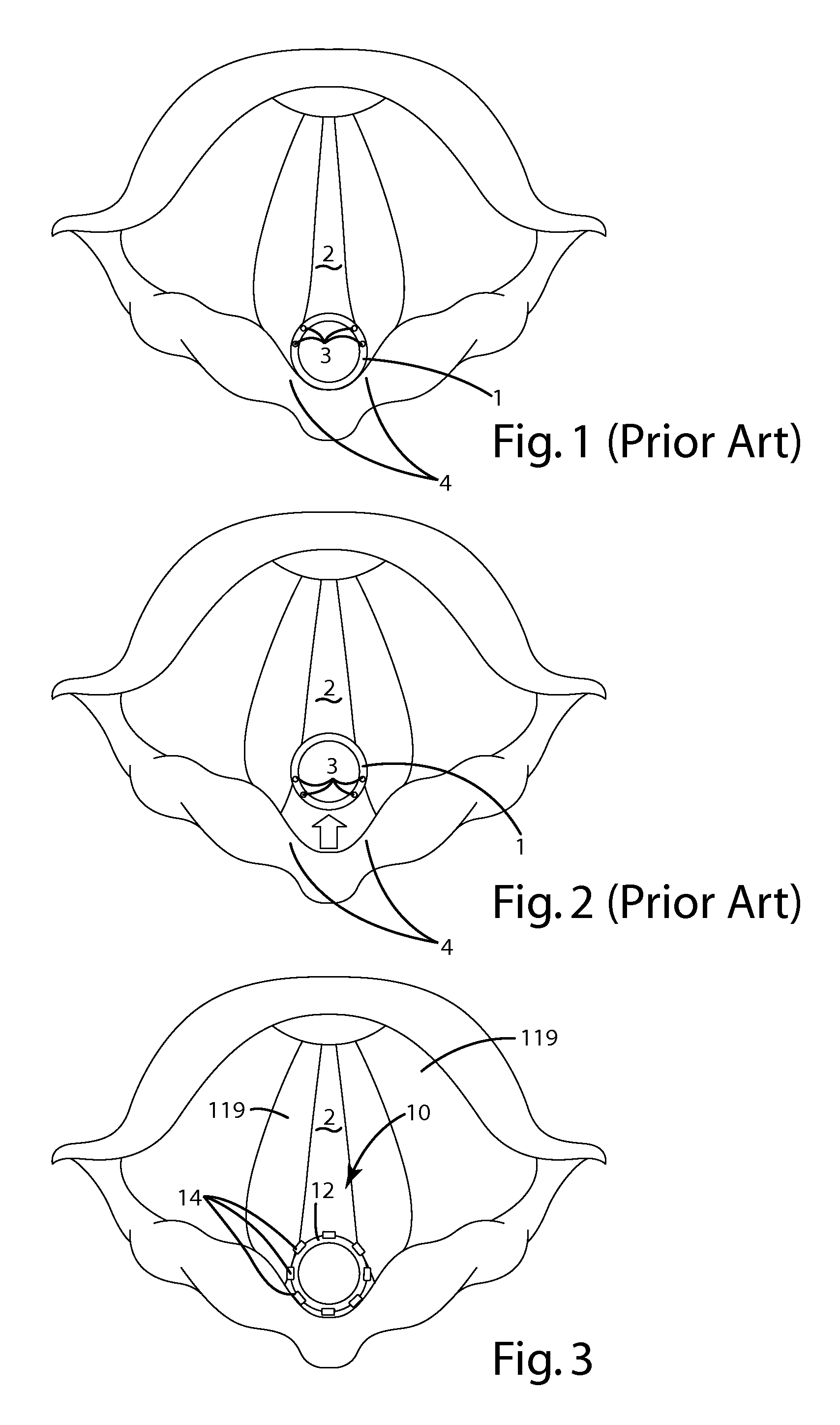 Nerve monitoring device