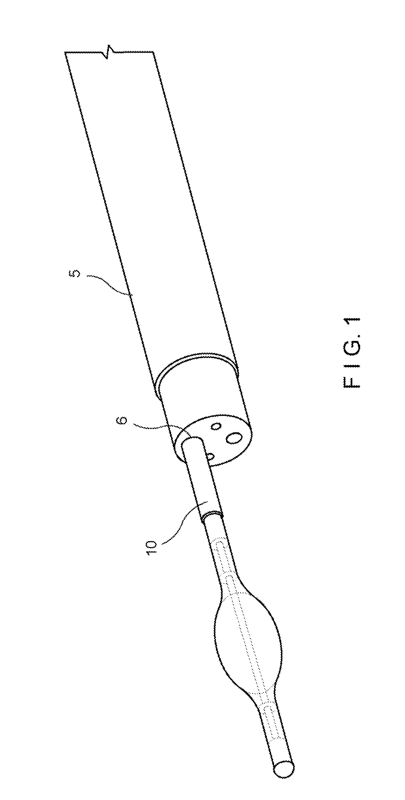 Detachable balloon catheter