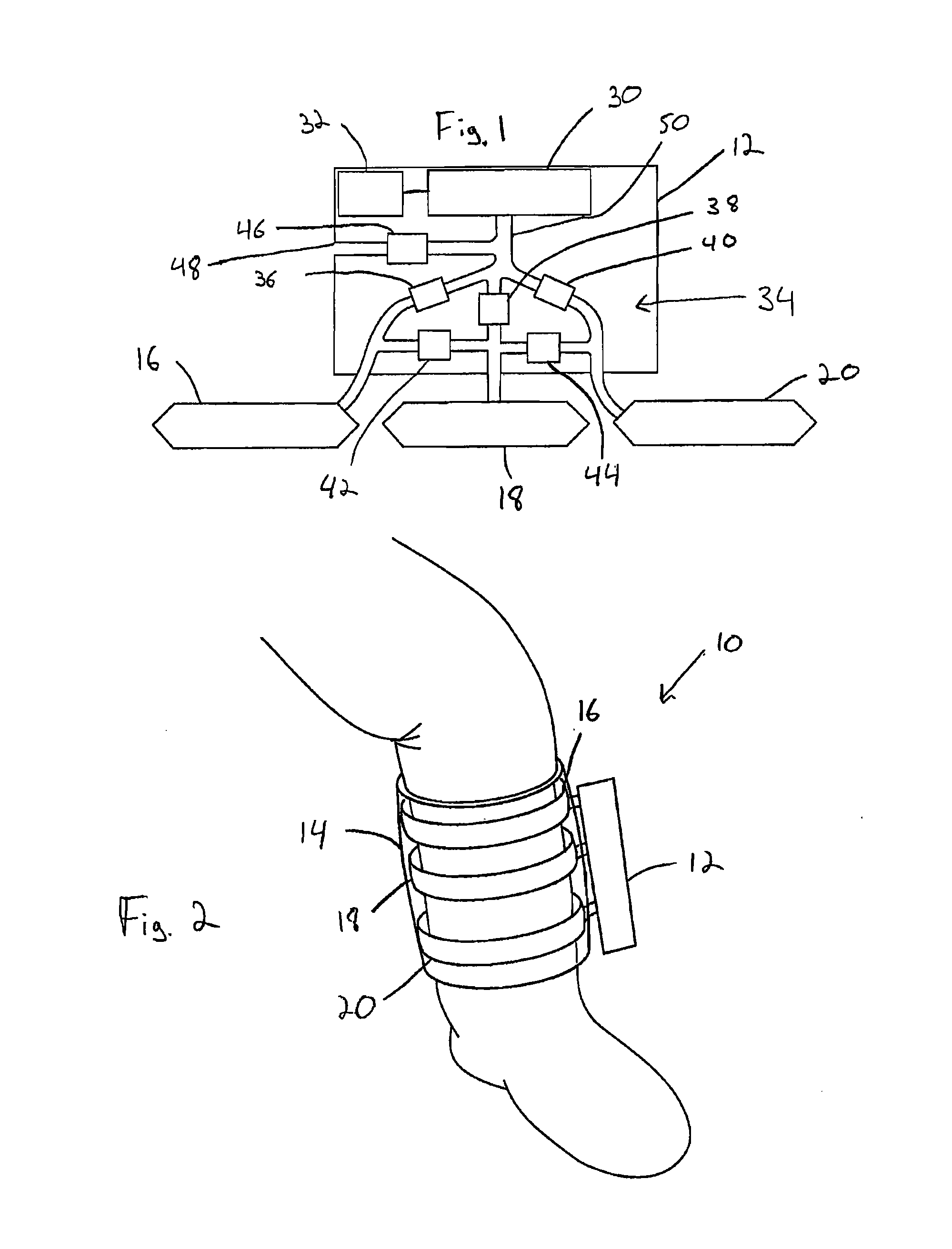 Blood clot prevention device