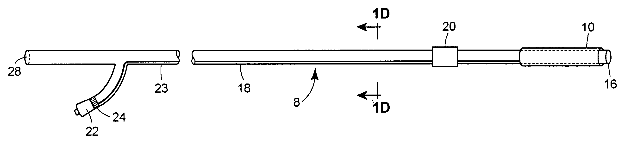 Single balloon ripening device with novel inserter and inflator