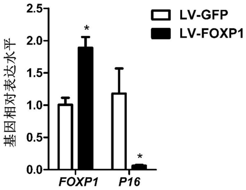 Method for delaying aging caused by in vitro culture of human bone marrow mesenchymal stem cells