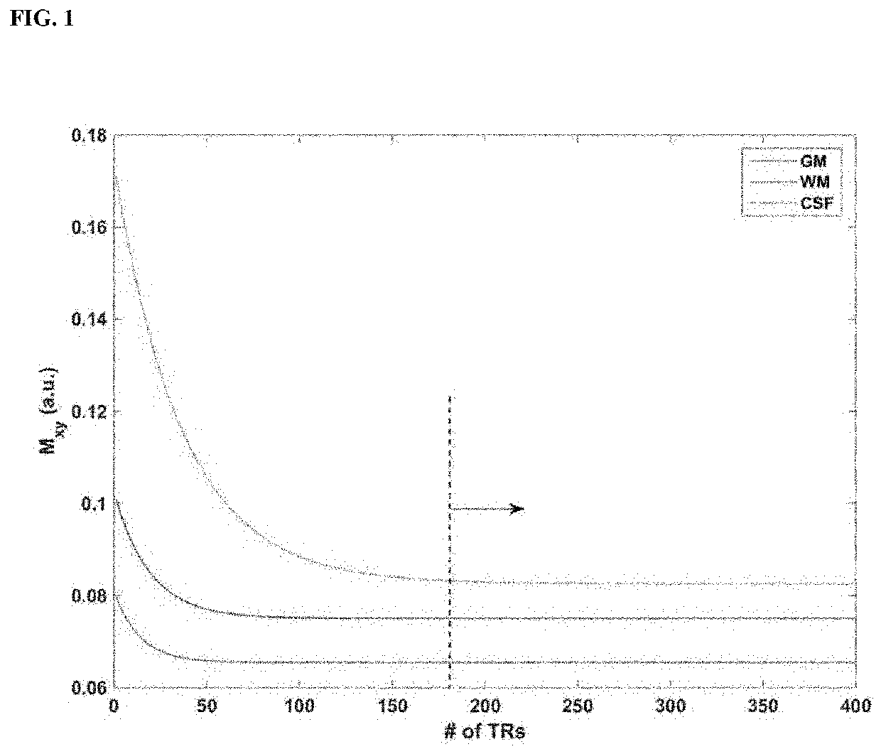 High-resolution cerebrospinal fluid-suppressed t2*-weighted magnetic resonance imaging of cortical lesions