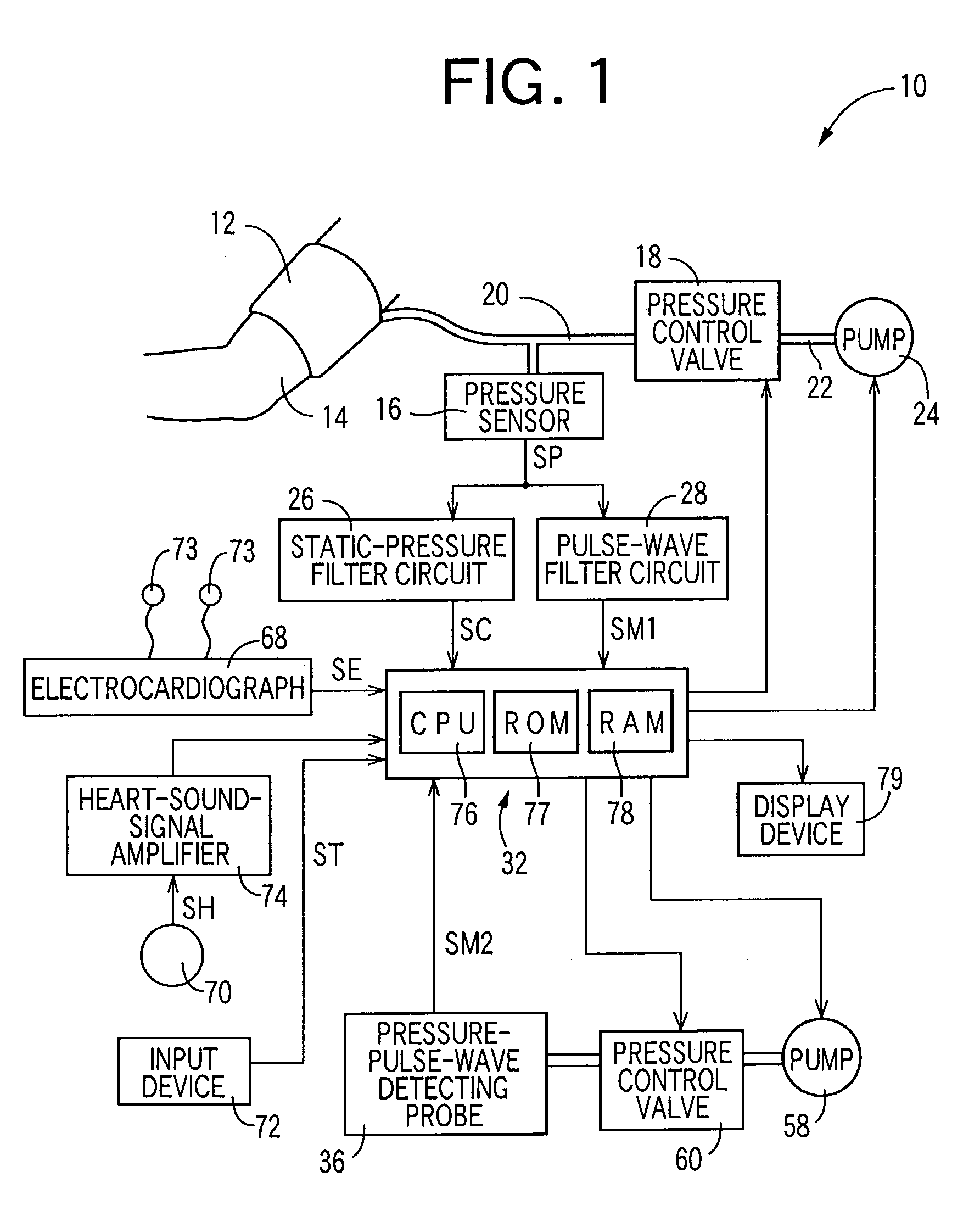 Arteriosclerosis inspecting apparatus