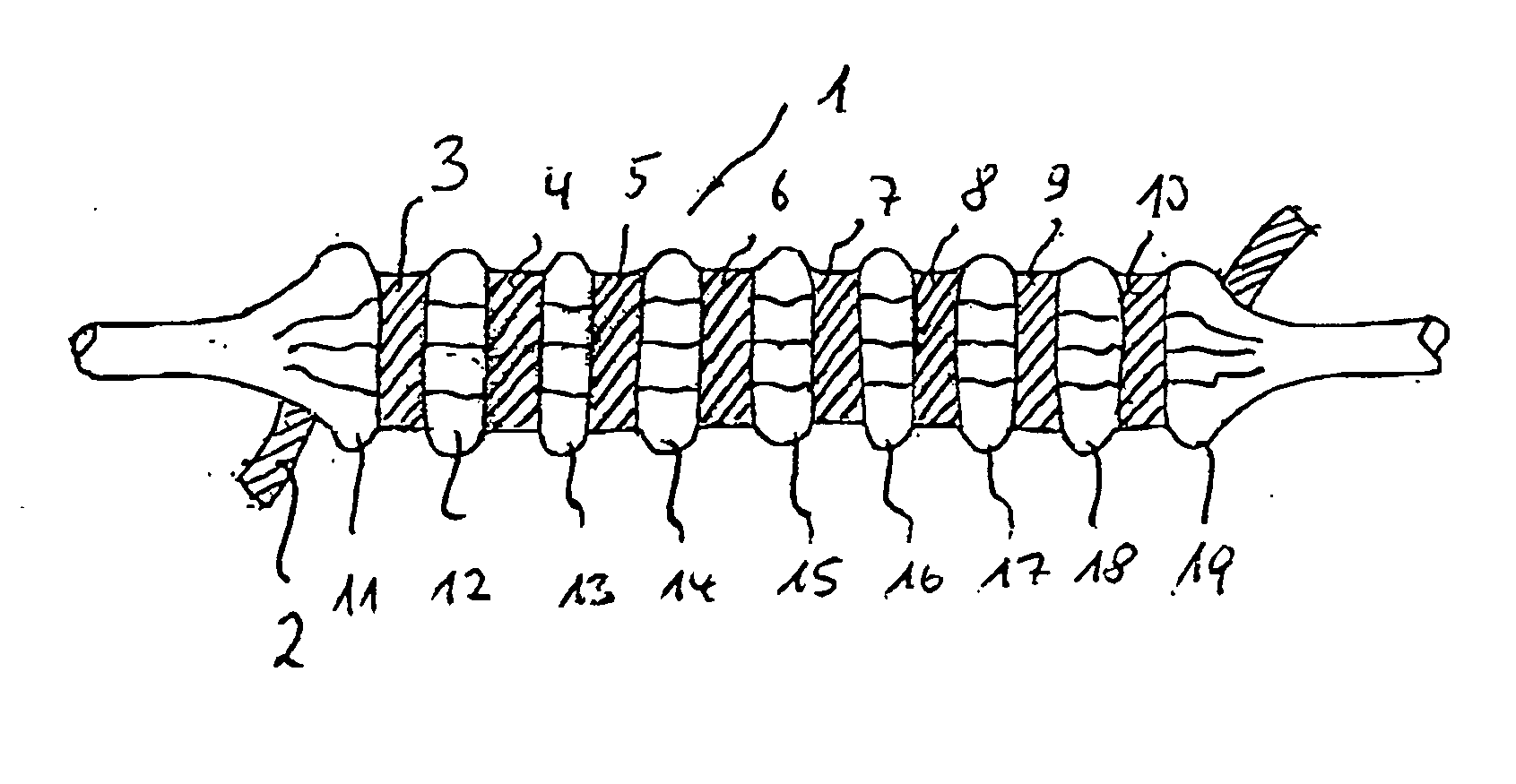 Method of trimming a balloon of a balloon catheter