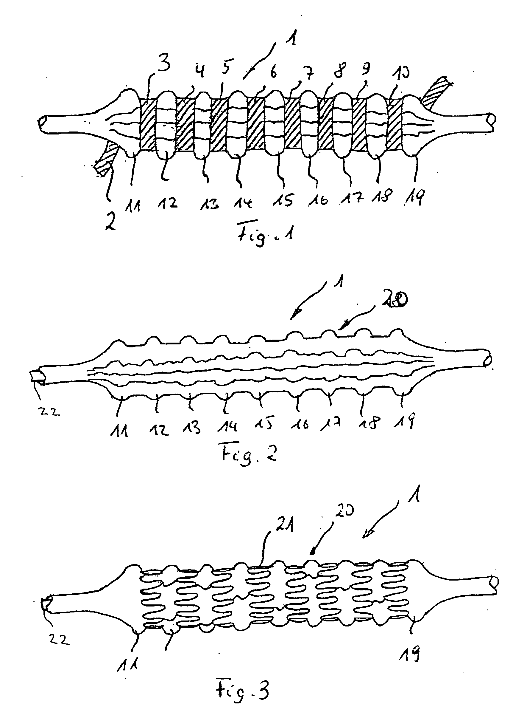 Method of trimming a balloon of a balloon catheter