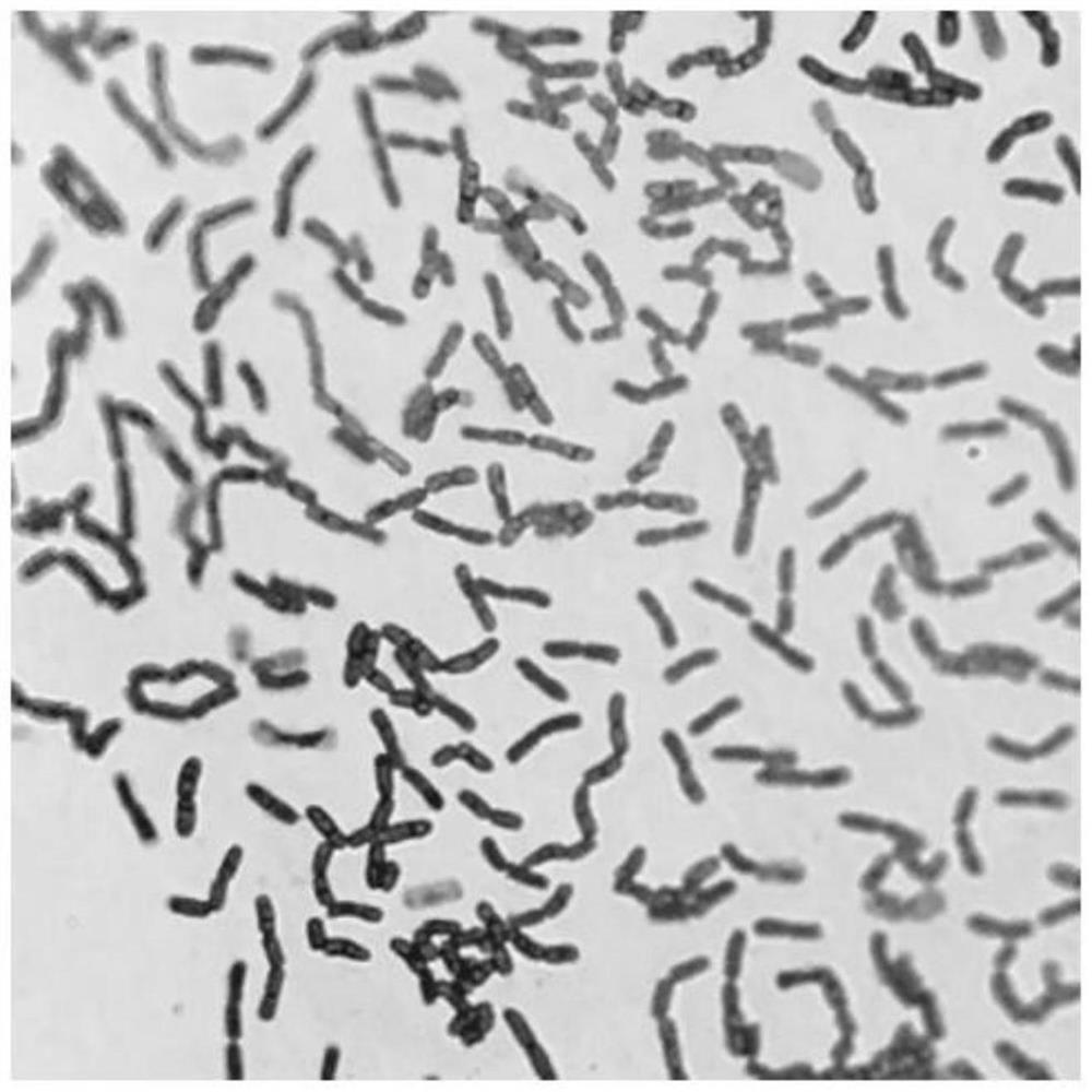 Lactic acid bacteria capable of degrading biogenic amine and application thereof