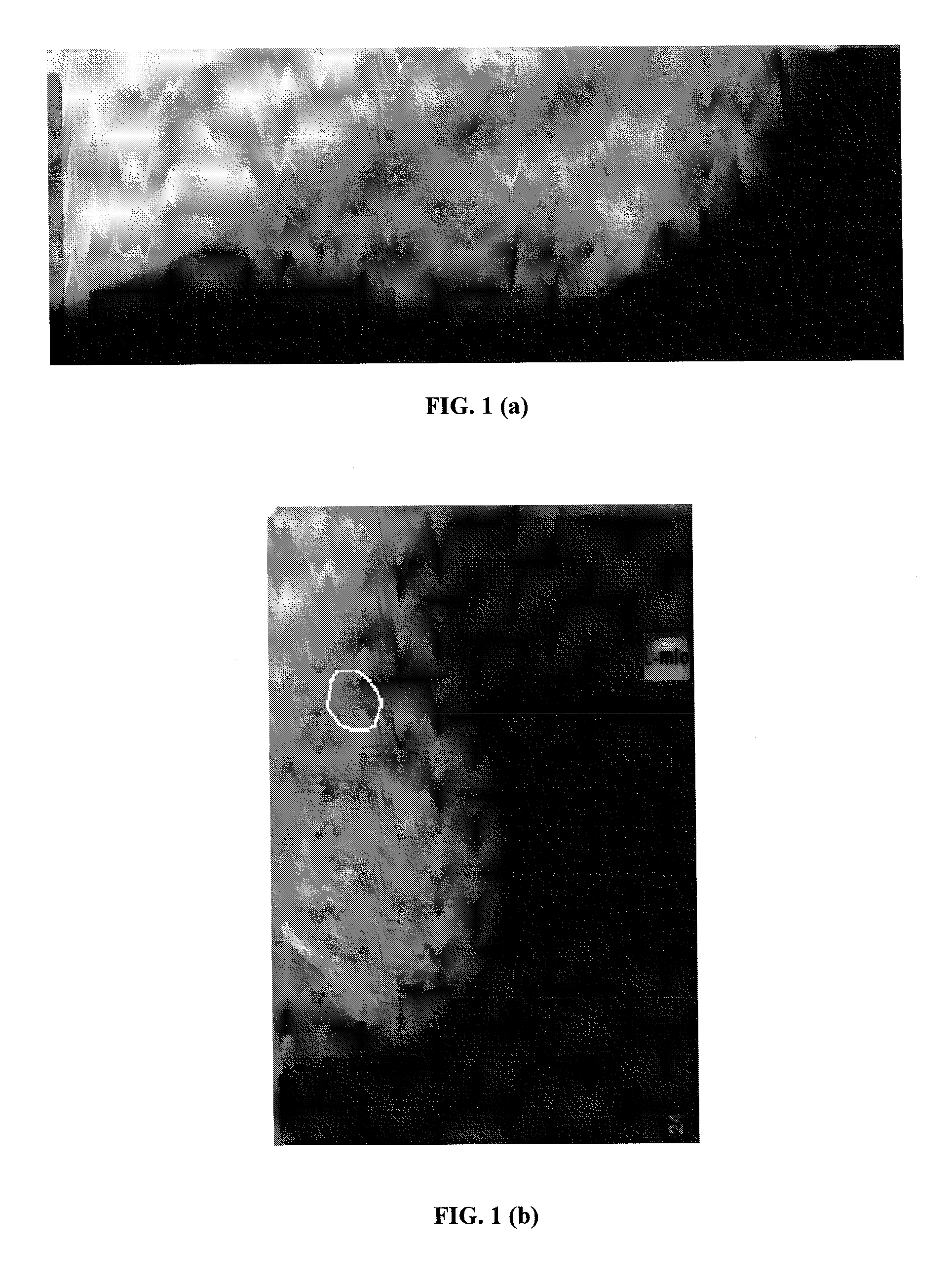 Method for Segmenting Digital Medical Image