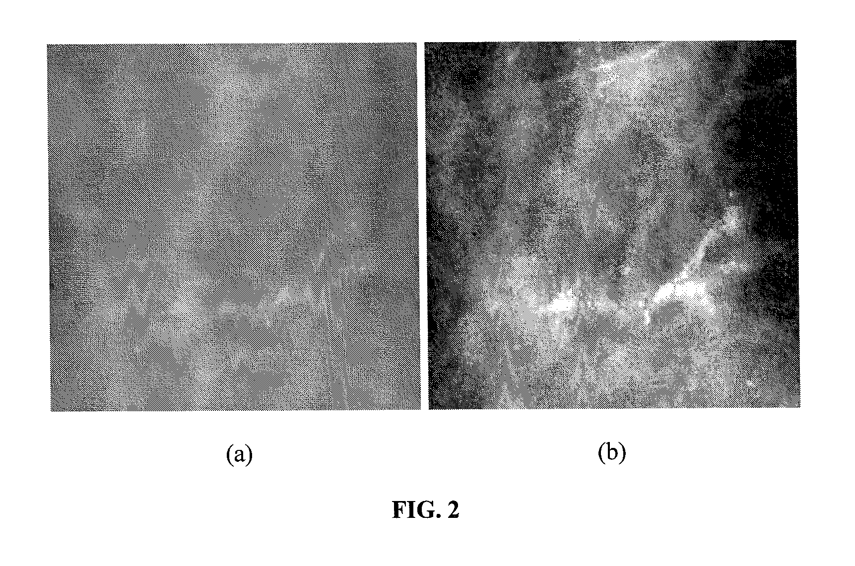 Method for Segmenting Digital Medical Image