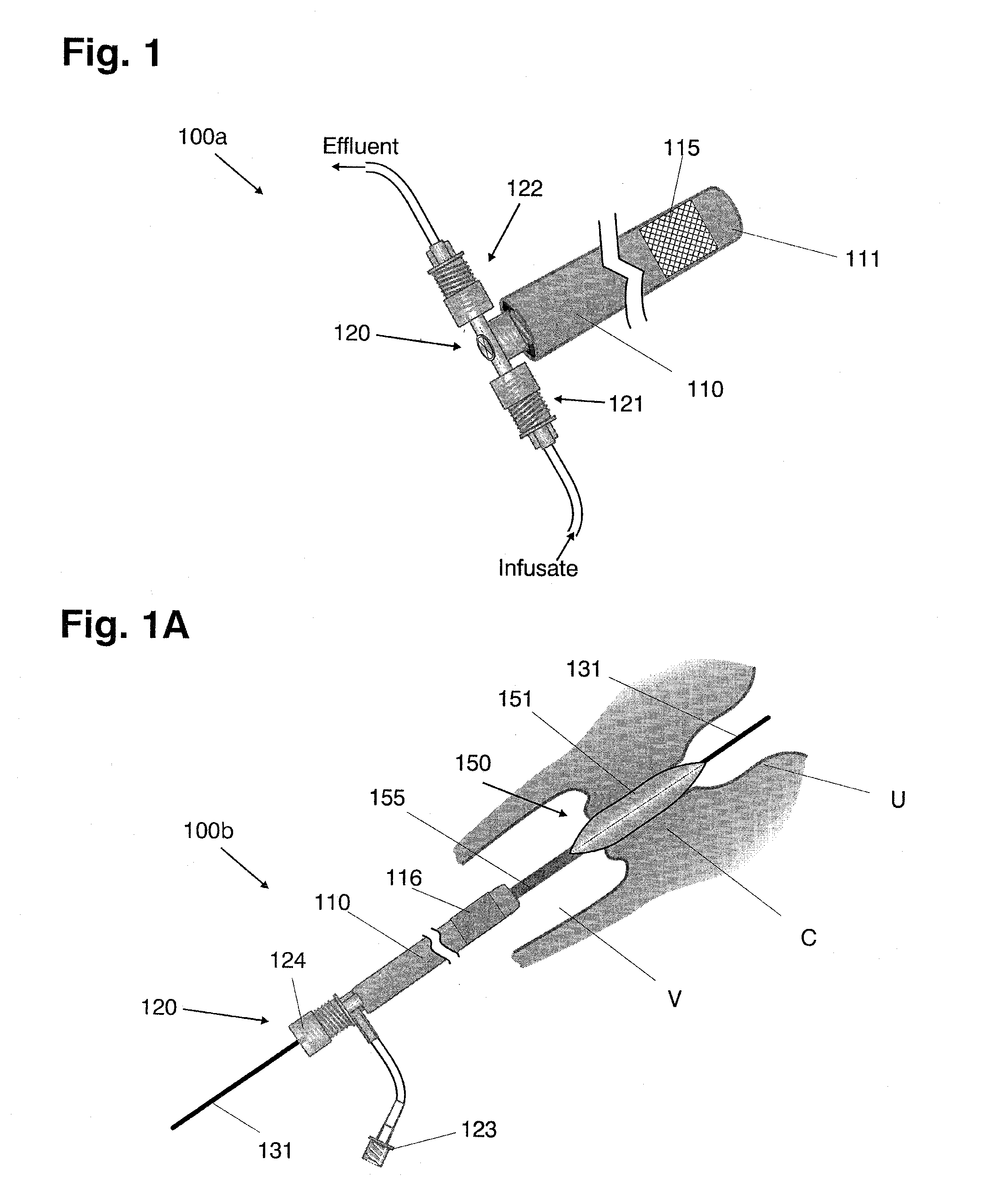 Systems and methods for preventing intravasation during intrauterine procedures