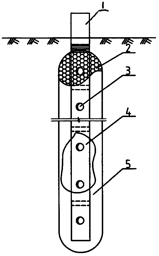 Dialysis device for managing soil pollution