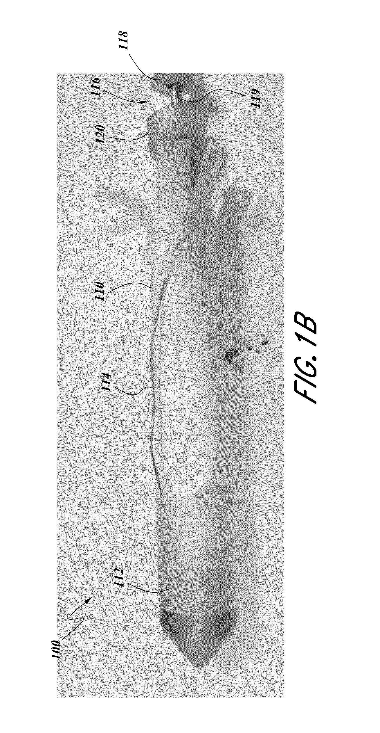 Prosthesis, delivery device and methods of use