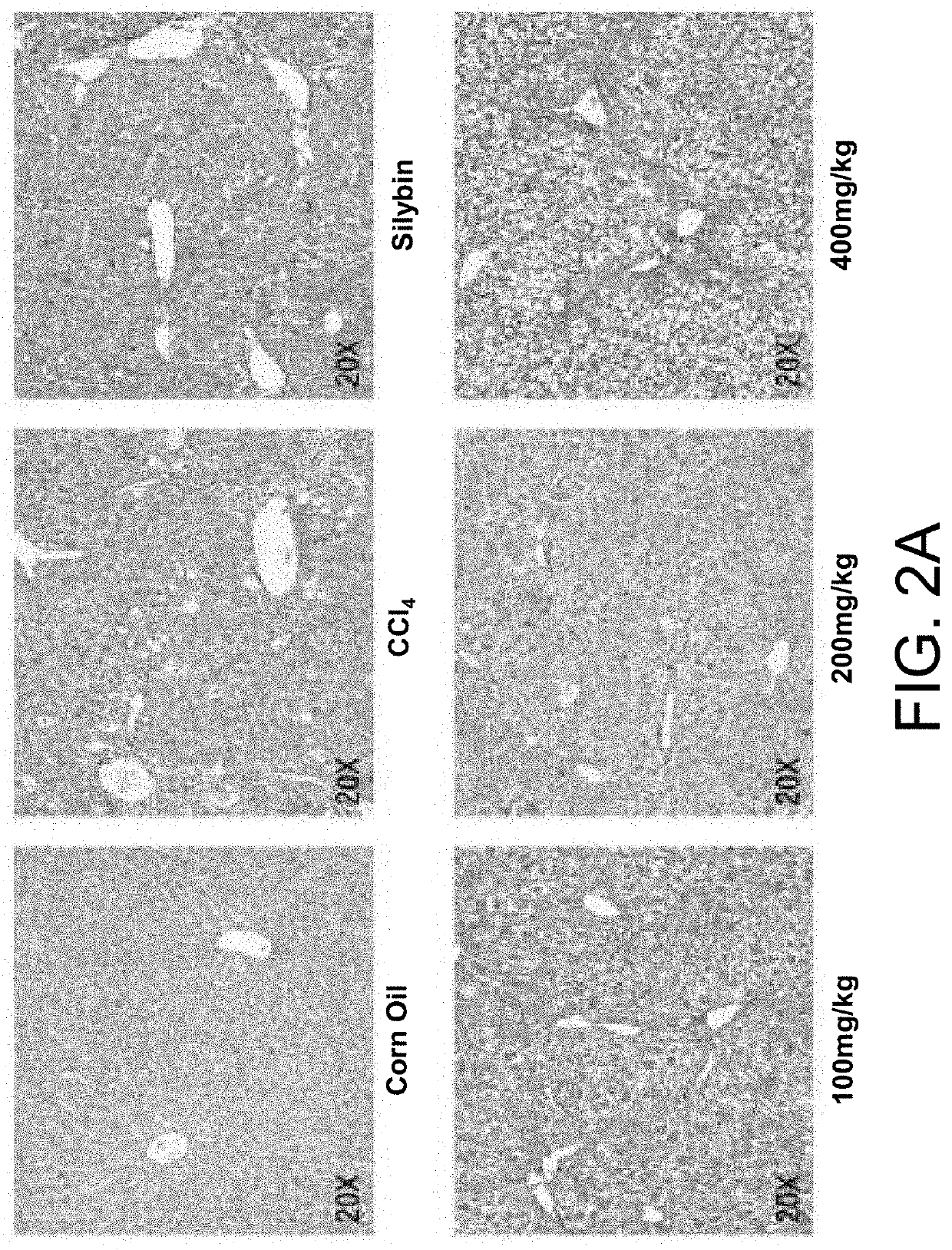 Application of longhu rendan in preparing medicament for preventing and/or treating liver fibrosis