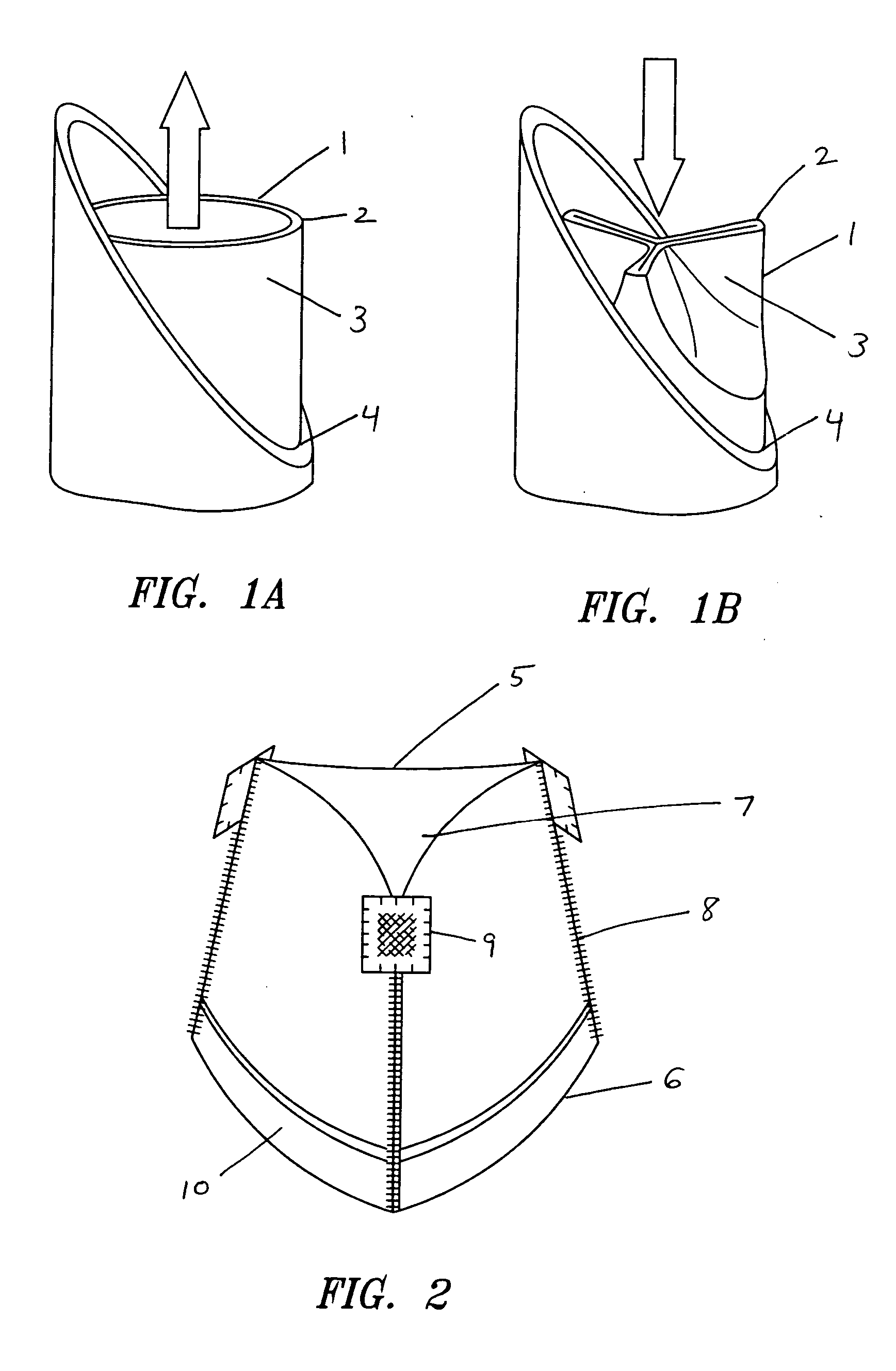 Minimally invasive valve replacement system