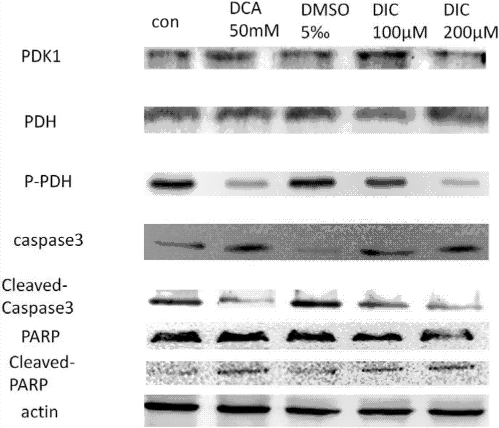 PDK1 inhibitor, composition containing inhibitor and application