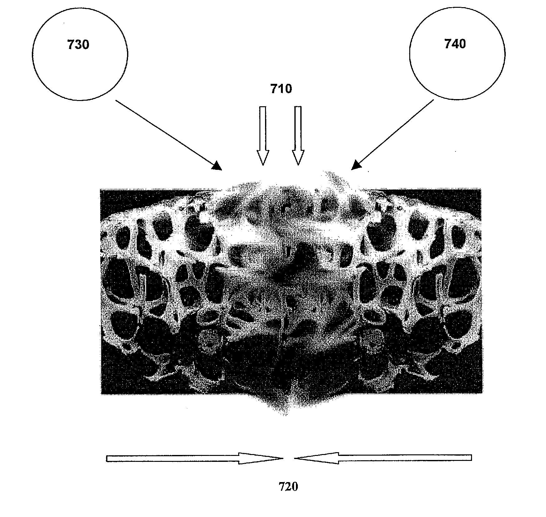 Methods and compositions for fusing bone during endoscopy procedures