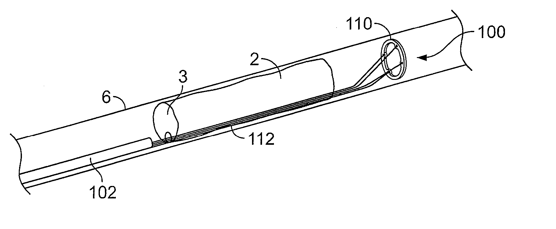 Methods for restoring blood flow within blocked vasculature