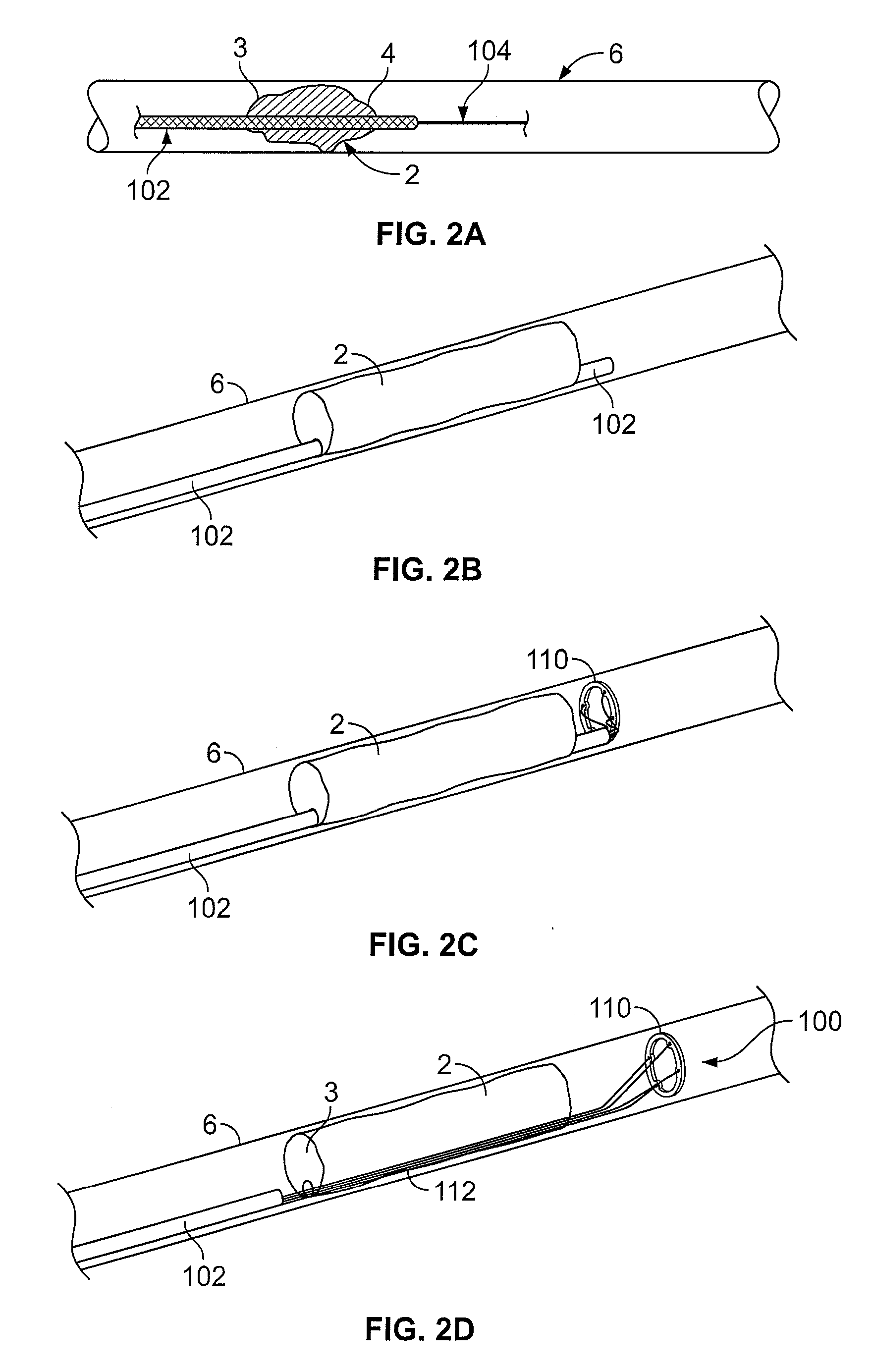 Methods for restoring blood flow within blocked vasculature