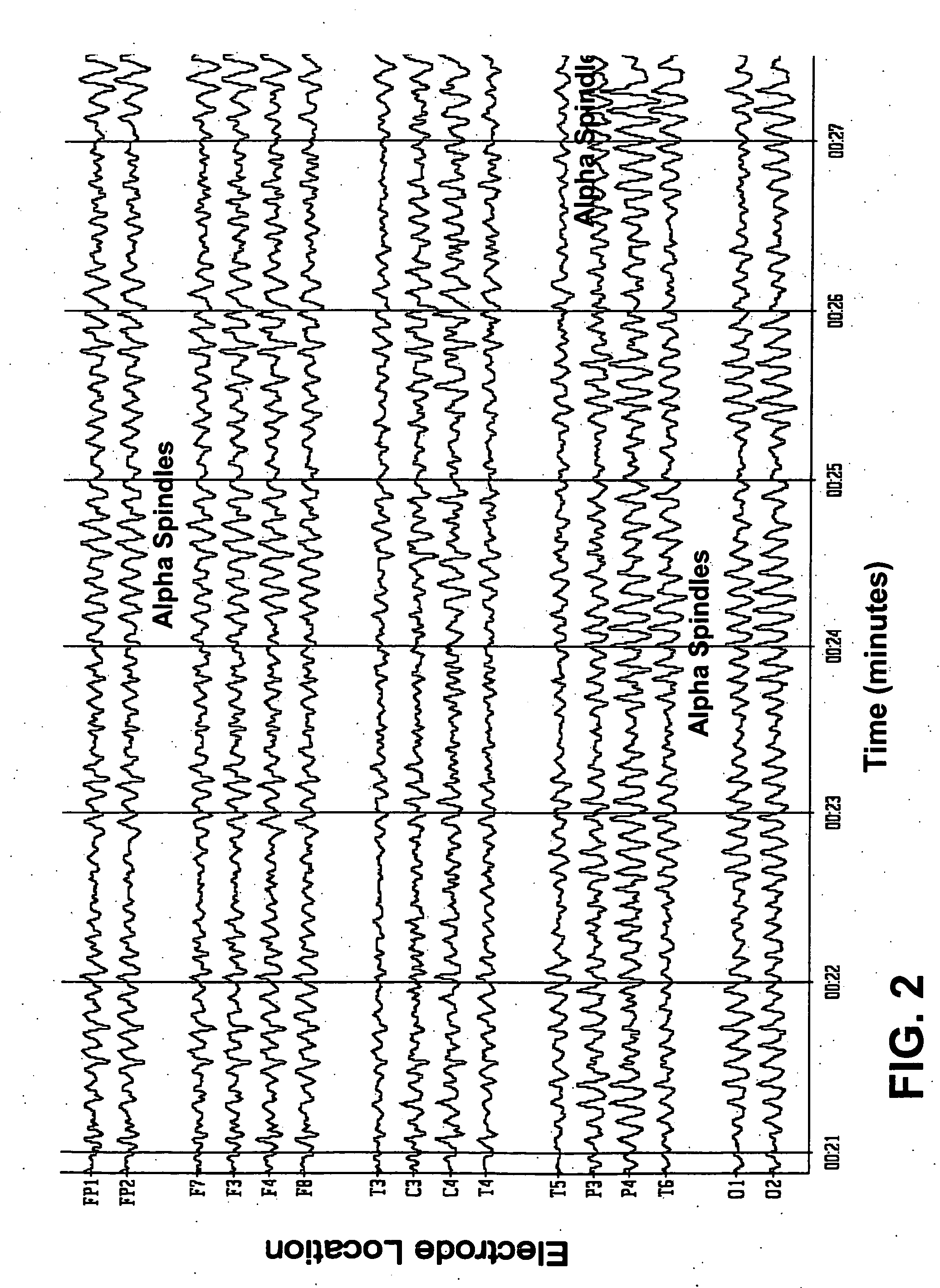 Stimulation of central nervous system