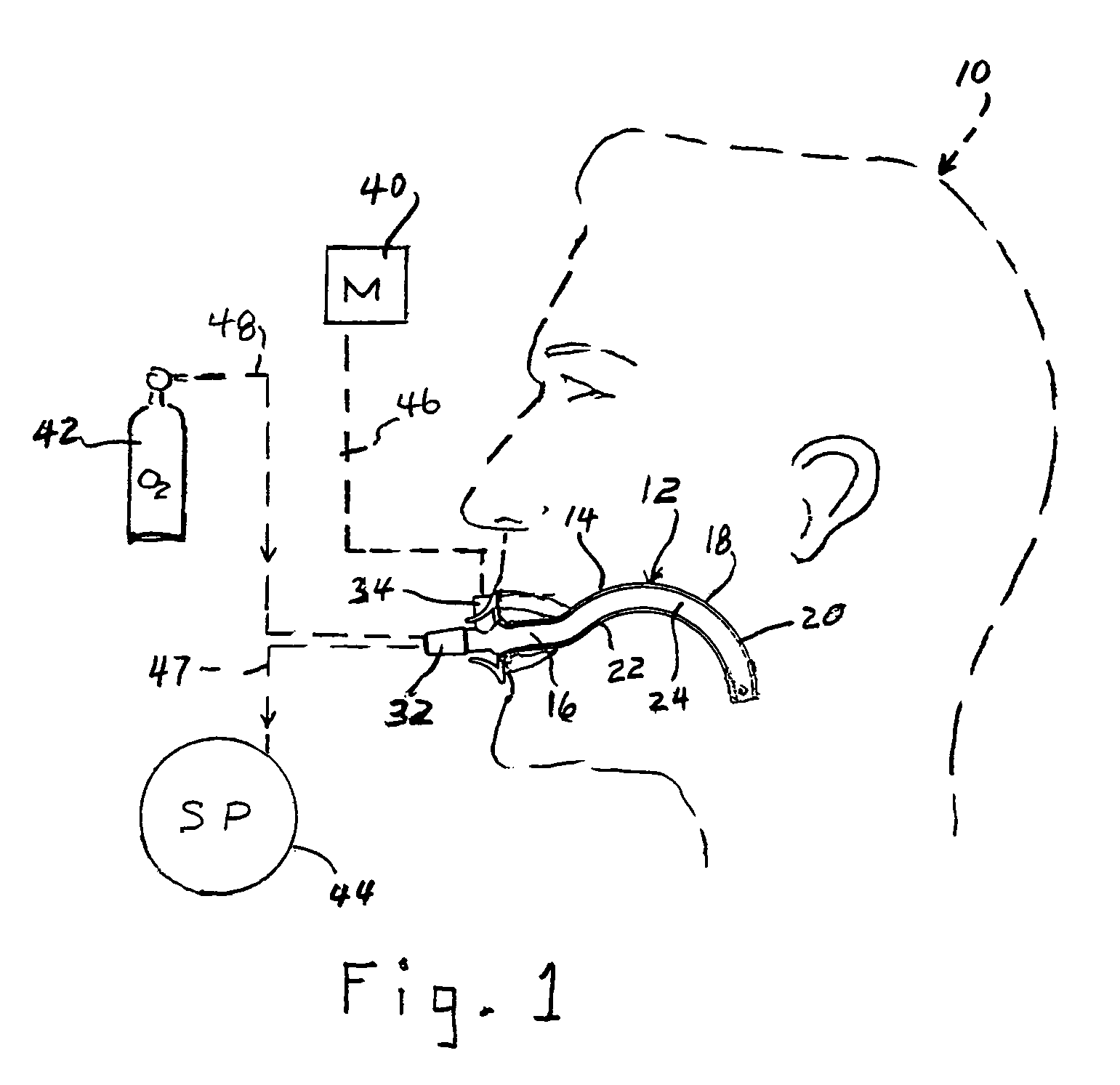 Oro-pharyngeal airway with breath monitor