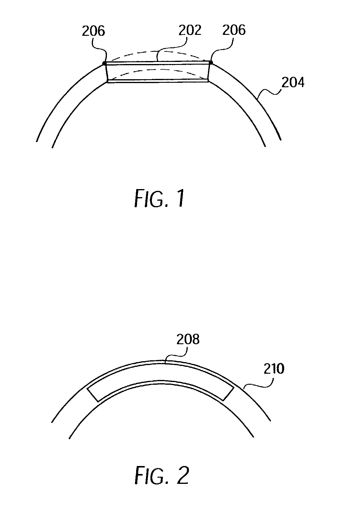 Longitudinally flexible stent