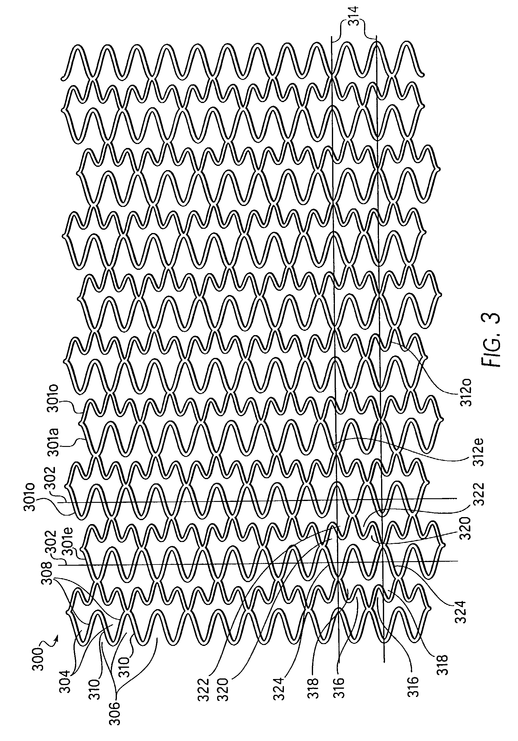 Longitudinally flexible stent