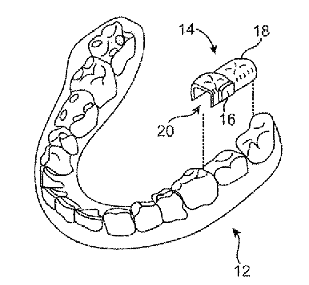 Headset systems and methods