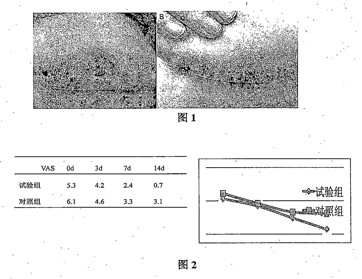 Mussel adhesive protein product and applications thereof in suppression of skin inflammations