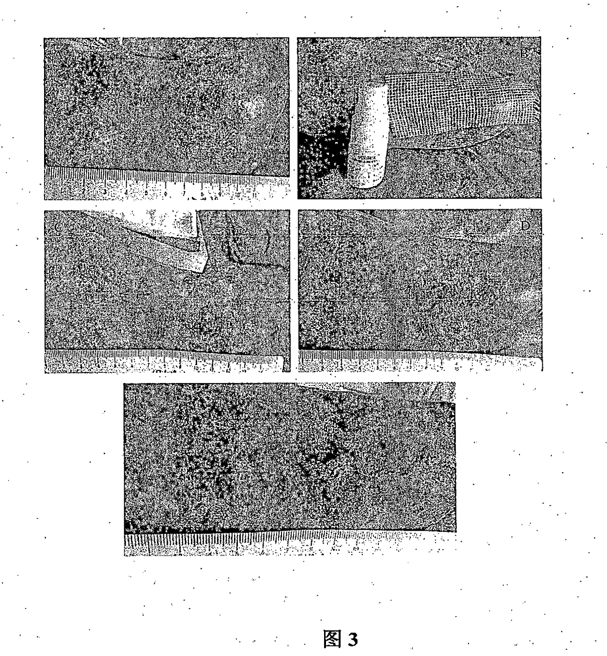 Mussel adhesive protein product and applications thereof in suppression of skin inflammations