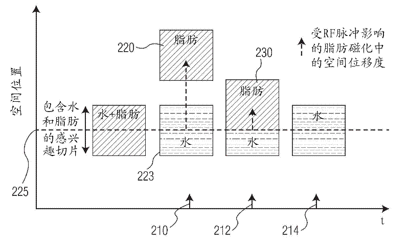 System for fat suppression in obtaining of MR image