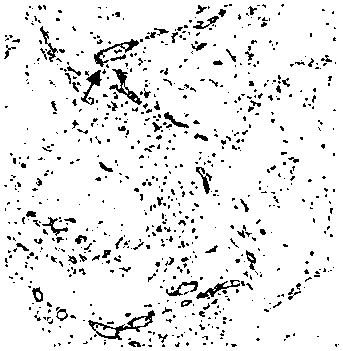 3D bioprinting in-vivo tumor model and building method thereof