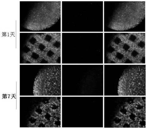 3D bioprinting in-vivo tumor model and building method thereof