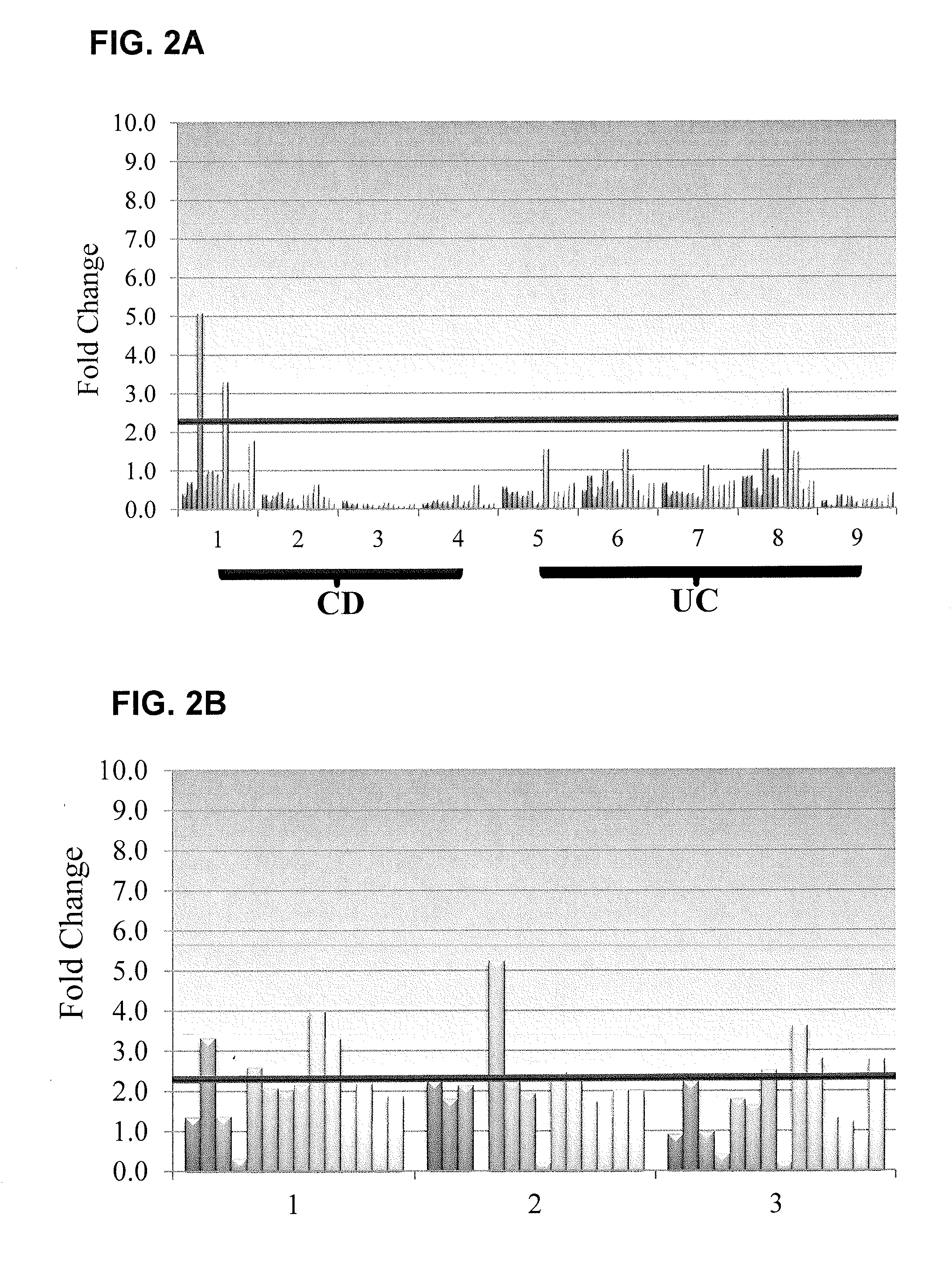 Methods for identifying inflammatory bowel disease patients with dysplasia or cancer