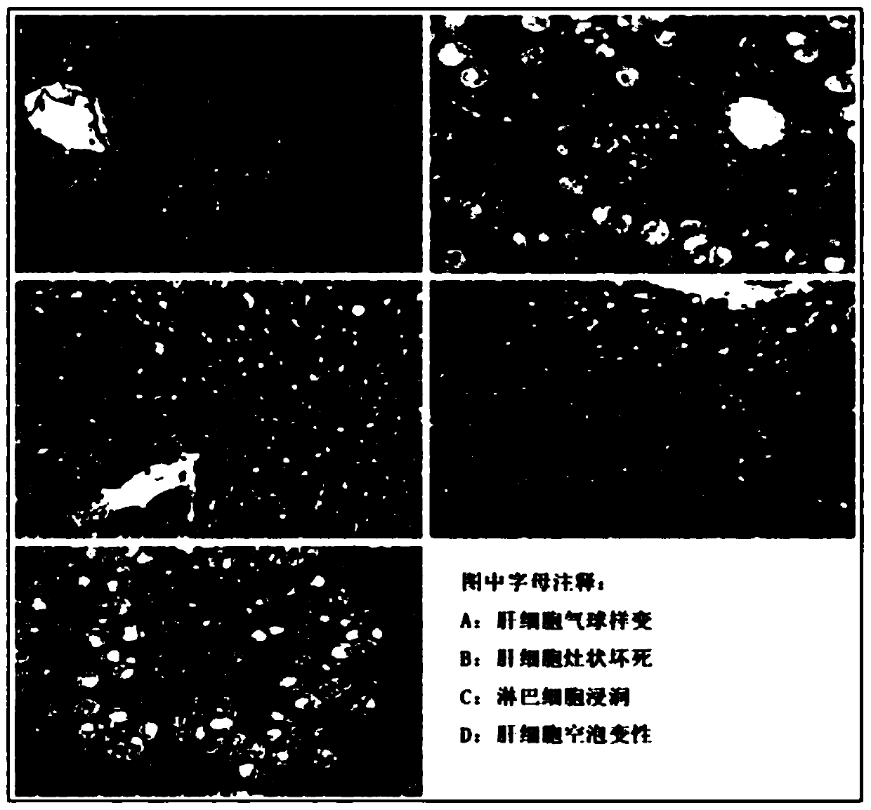 Beverage for regulating liver functions and preparation method and application thereof