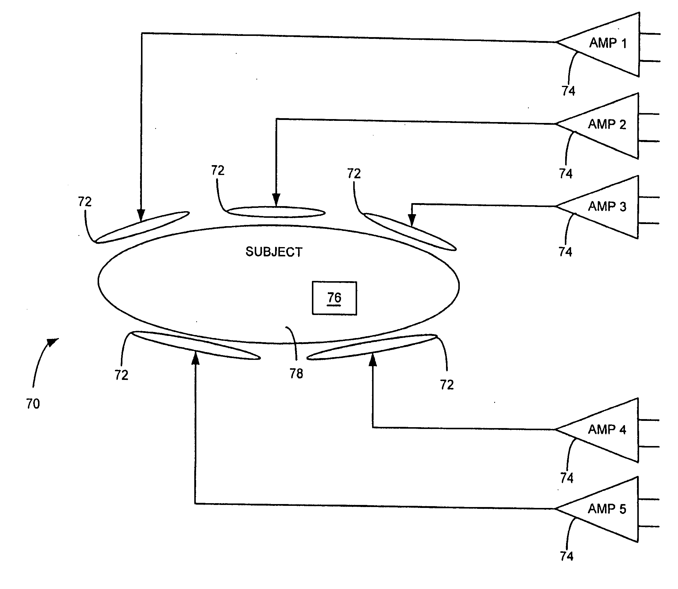 Method and apparatus to generate an RF excitation consistent with a desired excitation profile using a transmit coil array