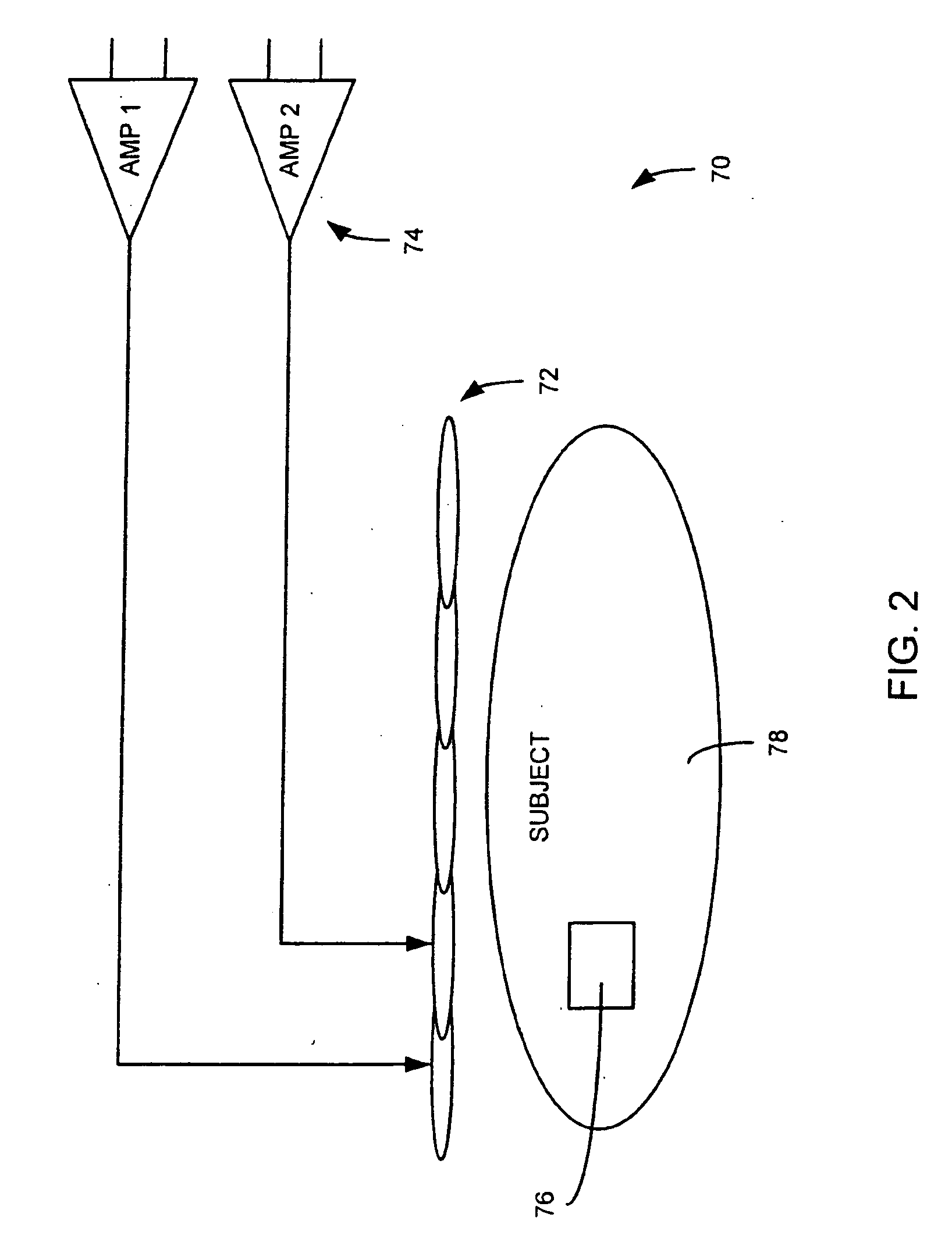 Method and apparatus to generate an RF excitation consistent with a desired excitation profile using a transmit coil array