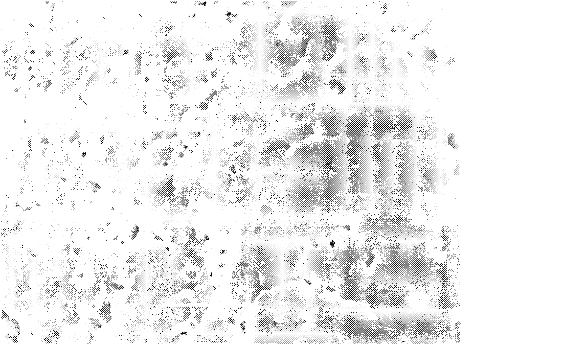 Method for preparing nano hydroxyapatite/polylactic acid composite microspheres