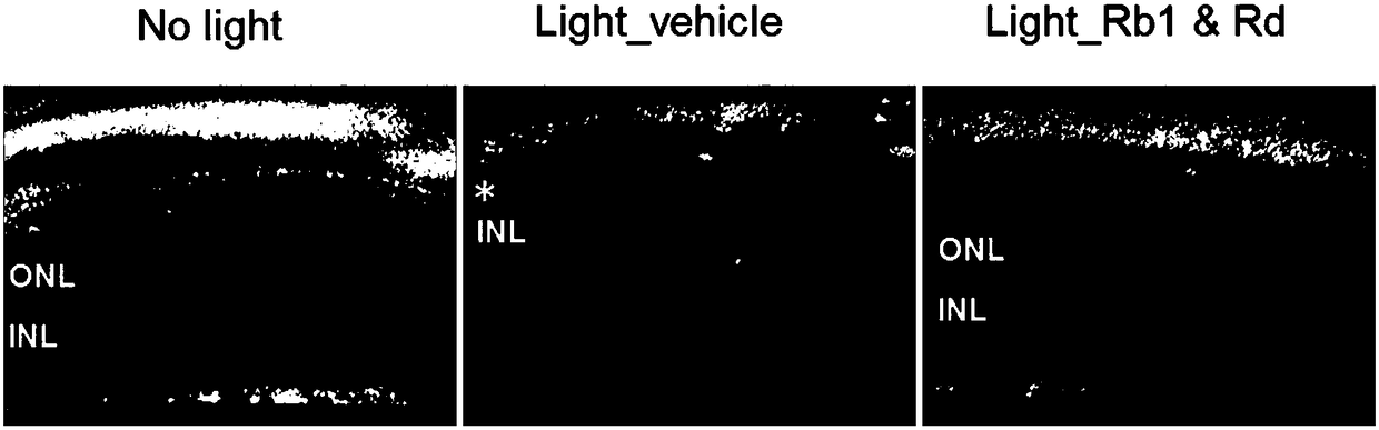 Combination of ginsenoside rb1 and rd and its application in the preparation of medicines for treating diseases related to photoreceptor cell death