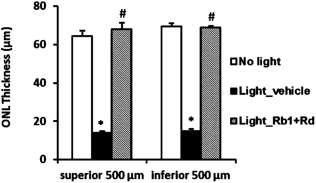 Combination of ginsenoside rb1 and rd and its application in the preparation of medicines for treating diseases related to photoreceptor cell death