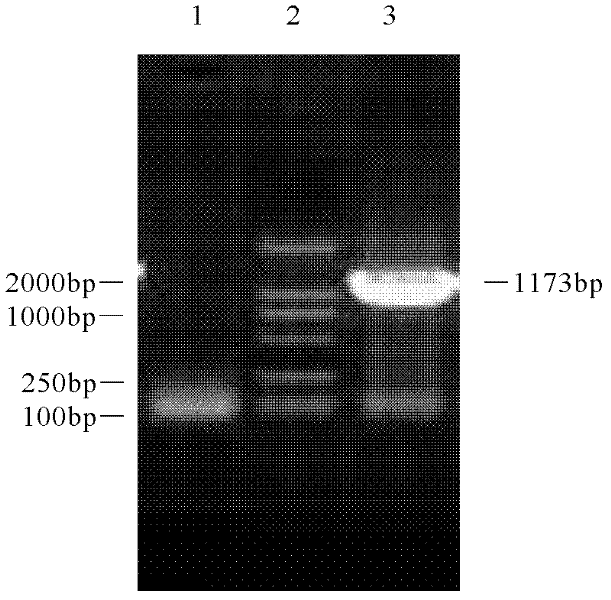 Recombinant yeast engineering strain coexpressed by proteins of chicken anaemia viruses VP1 and VP2, construction method thereof and application thereof