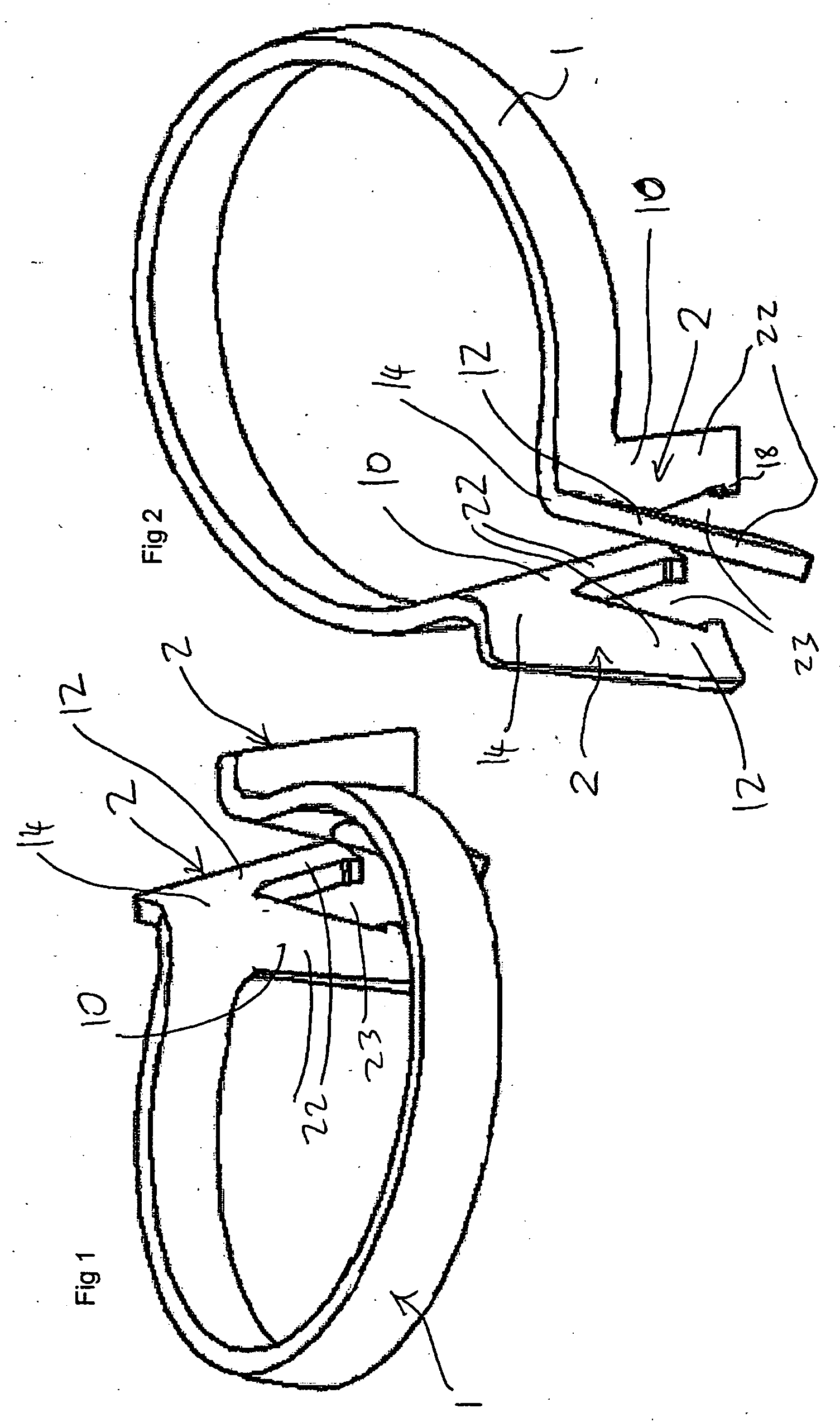 Matrix band retainer